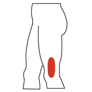 ITB Vancouver, Iliotibial Band Syndrome Treatment Vancouver | Backs In Action Vancouver