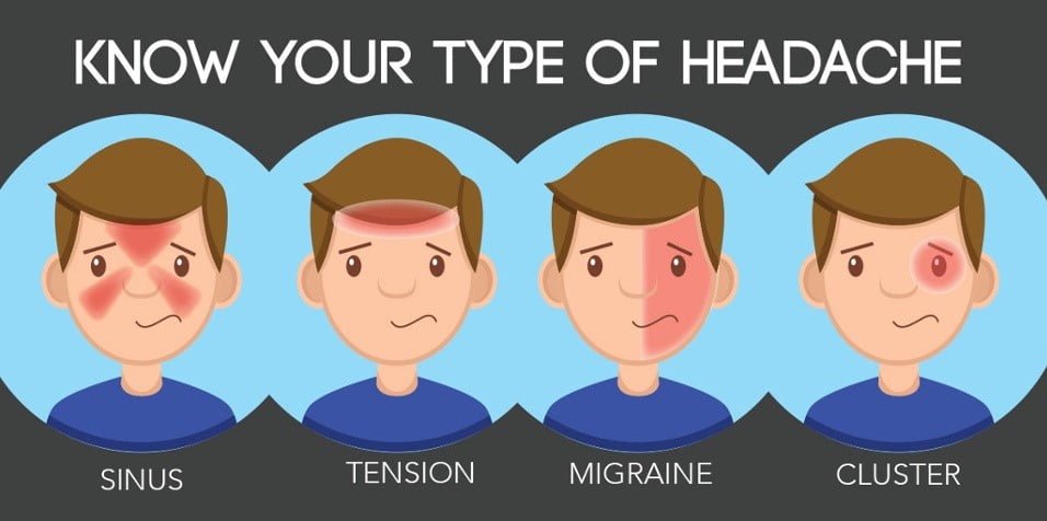 diagram of different types of headache showing sinus, tension, migraine, and cluster headaches