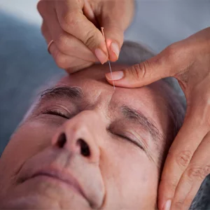 4.-Mens-Facial-Acupuncture 4.-Mens-Facial-Acupuncture