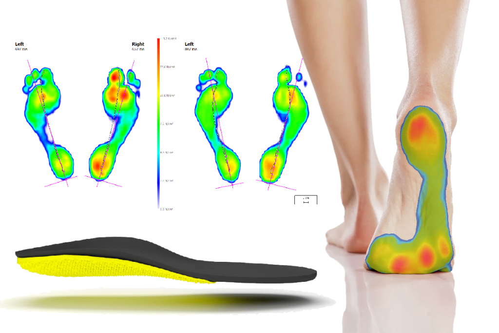 Gait Analysis Orthotics Foot Pain
