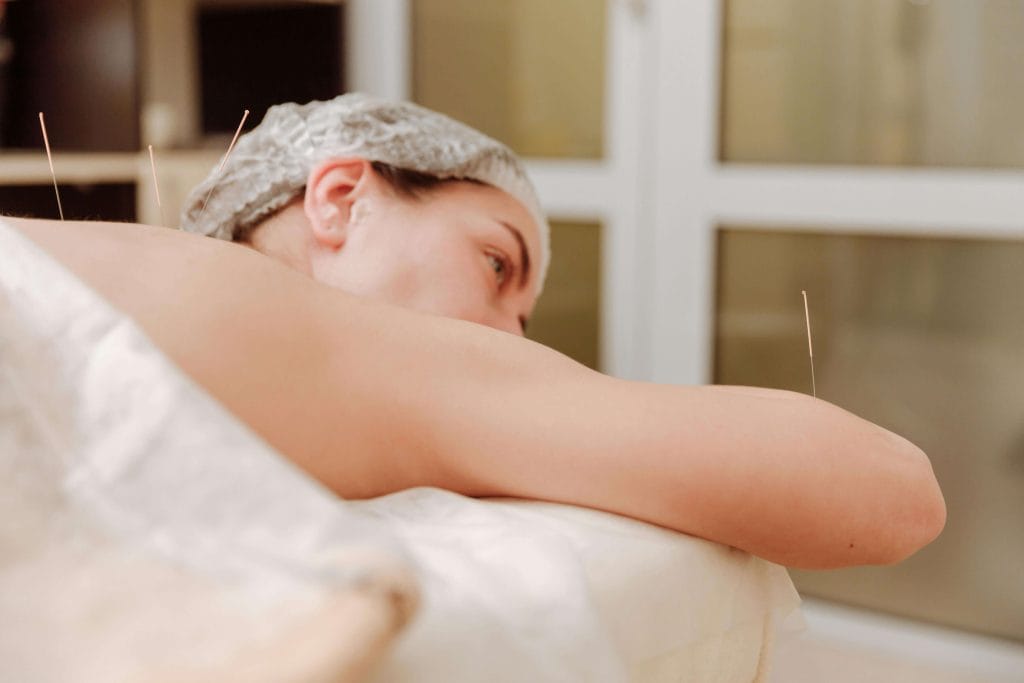 Kickstart Your New Year with An Integrated Approach to Health: Incorporating A Variety of Treatments Can Help You Meet Your Goals woman-acupuncture