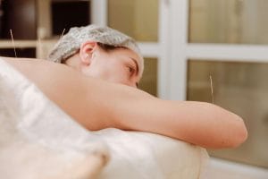 woman-acupuncture
