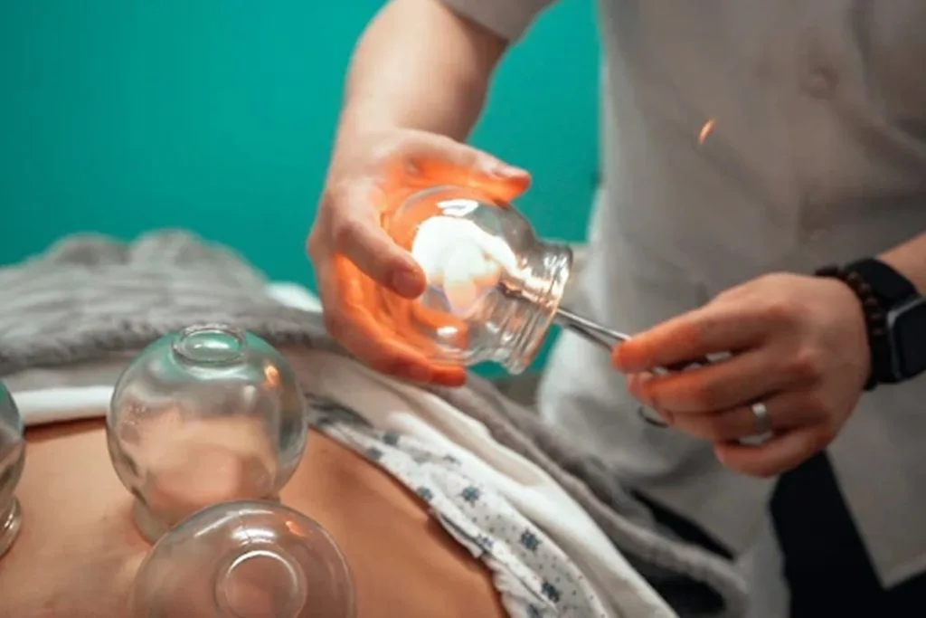 bia-acupuncture