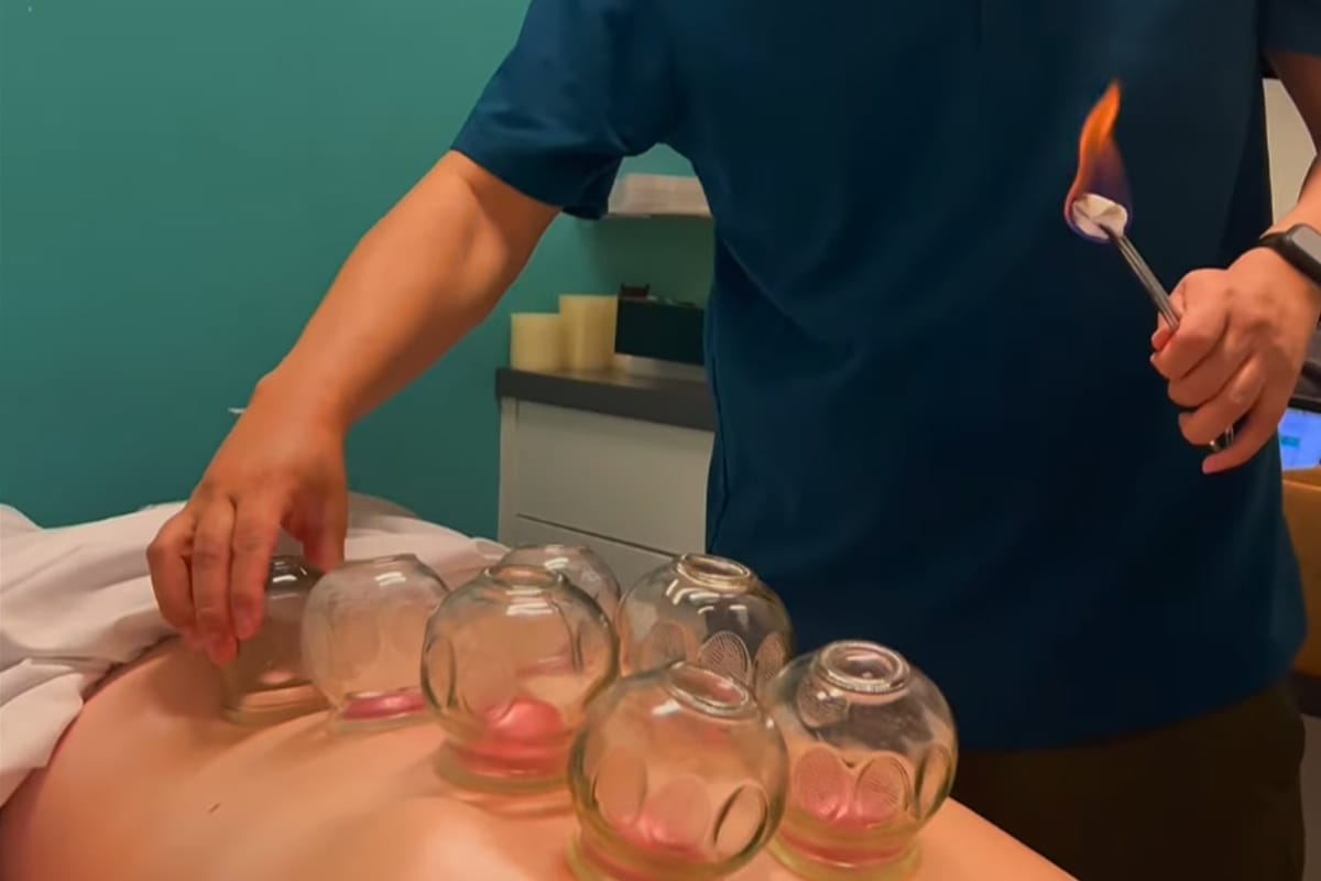 bia-albert-acupuncture